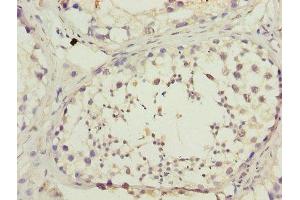 Immunohistochemistry of paraffin-embedded human testis tissue using ABIN7150890 at dilution of 1:100 (DNAL4 抗体  (AA 1-105))