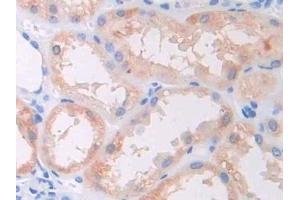 Immunohistochemistry (IHC) image for anti-CAP, Adenylate Cyclase-Associated Protein 1 (CAP1) (AA 33-218) antibody (ABIN7436249)