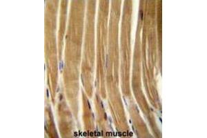 Immunohistochemistry (IHC) image for anti-Caspase 5, Apoptosis-Related Cysteine Peptidase (CASP5) antibody (ABIN2995932) (CASP5 抗体)