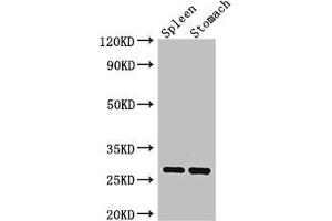 Western Blot Positive WB detected in: Mouse spleen tissue, Mouse stomach tissue All lanes: CTRB1 antibody at 3 μg/mL Secondary Goat polyclonal to rabbit IgG at 1/50000 dilution Predicted band size: 28 kDa Observed band size: 28 kDa (CTRB1 抗体  (AA 19-263))