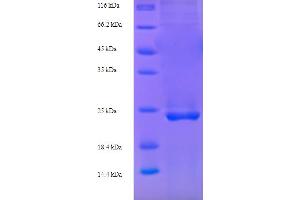 SDS-PAGE (SDS) image for Calcium/calmodulin-Dependent Protein Kinase II Inhibitor 1 (CAMK2N1) (AA 1-78), (full length) protein (His-SUMO Tag) (ABIN5709183)
