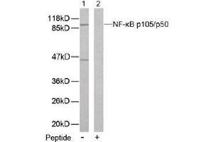Image no. 2 for anti-Nuclear Factor of kappa Light Polypeptide Gene Enhancer in B-Cells 1 (NFKB1) (Ser893) antibody (ABIN197124) (NFKB1 抗体  (Ser893))