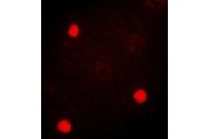 Immunofluorescent analysis of TIA1 staining in SKOV3 cells. (TIA1 抗体)