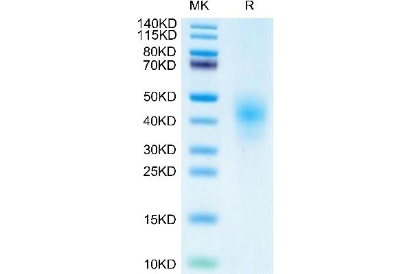 KLRK1 Protein (AA 73-216) (His tag)