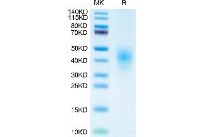 Cynomolgus NKG2D on Tris-Bis PAGE under reduced condition. (KLRK1 Protein (AA 73-216) (His tag))