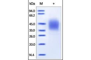 Human Fc gamma RIIIB/CD16b, His Tag on SDS-PAGE under reducing (R) condition. (FCGR3B Protein (AA 17-200) (His tag))