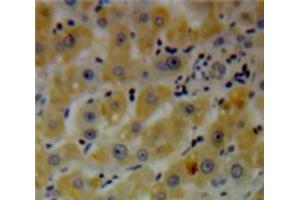 Used in DAB staining on fromalin fixed paraffin-embedded Liver tissue (DGKE 抗体  (AA 243-502))