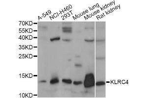Western blot analysis of extracts of various cell lines, using KLRC4 antibody. (KLRC4 抗体)