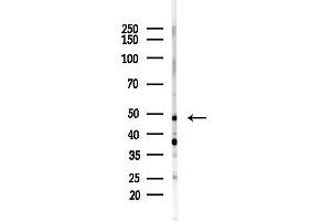 anti-Keratin 17 (KRT17) (C-Term) antibody