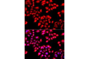 Immunofluorescence analysis of A549 cells using XRCC6 antibody. (XRCC6 抗体)