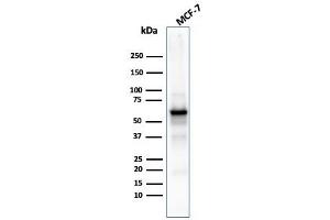 Western Blot Analysis of MCF-7 cell lysate using AKT1 Recombinant Mouse Monoclonal Antibody (rAKT1/2491). (Recombinant AKT1 抗体  (AA 85-189))