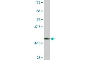 Western Blot detection against Immunogen (37. (Dopamine d2 Receptor 抗体  (AA 1-110))