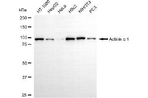 anti-Actinin, alpha 1 (ACTN1) antibody