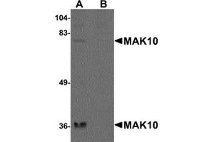 Western Blotting (WB) image for anti-MAK10 Homolog, Amino-Acid N-Acetyltransferase Subunit (MAK10) (N-Term) antibody (ABIN1031448)