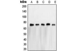 Western blot analysis of NXF1 expression in HeLa (A), A673 (B), K562 (C), Jurkat (D), A431 (E) whole cell lysates. (NXF1 抗体  (N-Term))