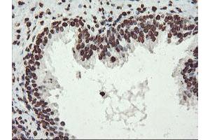 Image no. 11 for anti-F-Box Protein 21 (FBXO21) antibody (ABIN1498233) (FBXO21 抗体)