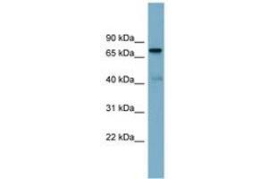 Image no. 1 for anti-P53-Induced Death Domain Protein (PIDD) (AA 143-192) antibody (ABIN6744153) (PIDD 抗体  (AA 143-192))