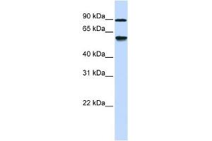ADHFE1 antibody used at 1 ug/ml to detect target protein. (ADHFE1 抗体  (Middle Region))