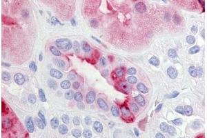 Immunohistochemistry (Paraffin-embedded Sections) (IHC (p)) image for anti-Prostaglandin E Receptor 2 (Subtype EP2), 53kDa (PTGER2) (C-Term) antibody (ABIN213471)