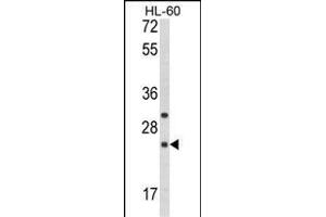 Western blot analysis of RGS1 Antibody (N-term) (ABIN652704 and ABIN2842468) in HL-60 cell line lysates (35 μg/lane). (RGS1 抗体  (N-Term))