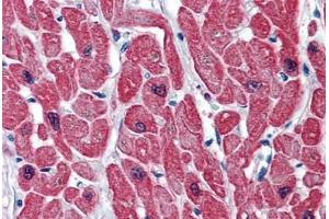 Human Heart: Formalin-Fixed, Paraffin-Embedded (FFPE)