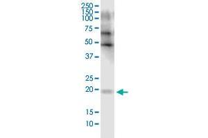 FLJ35767 monoclonal antibody (M03), clone 2F3. (FLJ35767 (AA 1-164) 抗体)