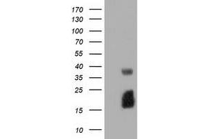 Western Blotting (WB) image for anti-Ephrin A2 (EFNA2) antibody (ABIN1497955) (Ephrin A2 抗体)