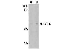 Image no. 1 for anti-Leucine-Rich Repeat LGI Family, Member 4 (LGI4) (C-Term) antibody (ABIN1492213) (LGI4 抗体  (C-Term))