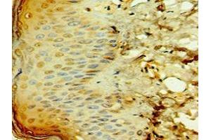 Immunohistochemistry of paraffin-embedded human skin tissue using ABIN7171674 at dilution of 1:100