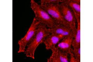 Immunofluorescence of human HeLa cells stained with monoclonal anti-human KCDT15 antibody (1:500) with Texas Red (Red). (KCTD15 抗体  (AA 1-234))