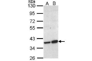 WB Image Sample (30 ug of whole cell lysate) A: Molt-4 , B: Raji 10% SDS PAGE antibody diluted at 1:1000 (ACMSD 抗体)