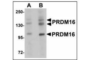 Western blot analysis of PRDM16 in rat brain tissue lysate with after heat-induced antigen retrieval at (A) 1 and (B) 2 µg/ml. (PRDM16 抗体  (C-Term))