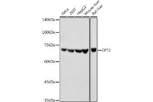 Western blot analysis of extracts of various cell lines, using CPT2 antibody (ABIN6129249, ABIN6138983, ABIN6138984 and ABIN6216045) at 1:1000 dilution. (CPT2 抗体  (AA 1-180))