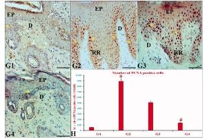 The effects of ustekinumab and CUC on PCNA IE in IQ-induced psoriatic skin lesions. (PCNA 抗体)