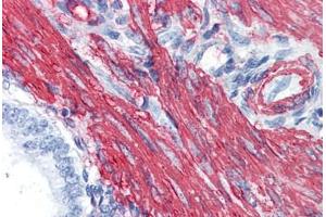 Immunohistochemistry (Formalin-fixed Paraffin-embedded Sections) (IHC (fp)) image for anti-Actin, alpha 2, Smooth Muscle, Aorta (ACTA2) (AA 1-378) antibody (ABIN790443)