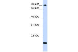 Western Blotting (WB) image for anti-TSR1, 20S rRNA Accumulation, Homolog (TSR1) antibody (ABIN2459005) (TSR1 抗体)