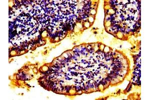 Immunohistochemistry (IHC) image for anti-ATP-Binding Cassette, Sub-Family C (CFTR/MRP), Member 2 (ABCC2) (AA 724-947) antibody (ABIN7146636)