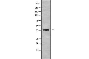 Western blot analysis of LT4R1 using HepG2 whole cell lysates (Leukotriene B4 Receptor/BLT 抗体)