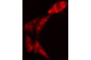 ABIN6274326 staining Hela cells by IF/ICC.