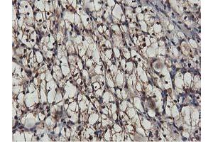 Image no. 3 for anti-V-Akt Murine Thymoma Viral Oncogene Homolog 1 (AKT1) antibody (ABIN1496556) (AKT1 抗体)