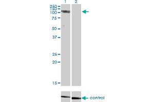 Western blot analysis of CLCN2 over-expressed 293 cell line, cotransfected with CLCN2 Validated Chimera RNAi (Lane 2) or non-transfected control (Lane 1). (CLCN2 抗体  (AA 38-387))