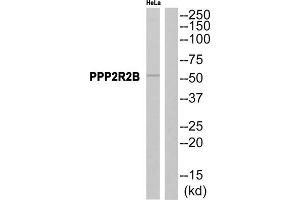 Western blot analysis of extracts from HeLa cells, using PPP2R2B antibody. (PPP2R2B 抗体  (Internal Region))