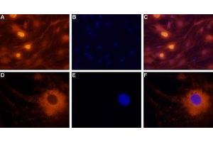 Expression of neuropeptide Y2 receptor in rat dorsal root ganglion cells - Immunocytochemical staining of rat dorsal root ganglion (DRG) neurons. (NPY2R 抗体  (Intracellular))