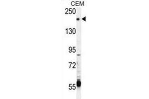 Western Blotting (WB) image for anti-Transient Receptor Potential Cation Channel, Subfamily M, Member 6 (TRPM6) antibody (ABIN3003652) (TRPM6 抗体)
