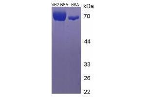 Image no. 2 for Vitamin B2 (Riboflavin) protein (BSA) (ABIN1880198) (Vitamin B2 Protein (BSA))
