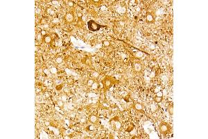 Immunohistochemistry of paraffin-embedded mouse spinal cord using ENO2 Rabbit mAb (ABIN7266959) at dilution of 1:100 (40x lens). (ENO2/NSE 抗体)