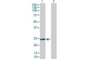 Western Blot analysis of RPIA expression in transfected 293T cell line by RPIA MaxPab polyclonal antibody. (Ribose 5-Phosphate Isomerase A (RPIA) (AA 1-237) 抗体)