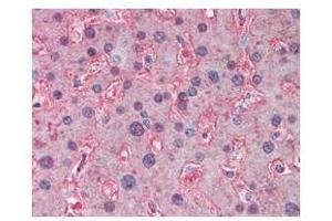 anti-APOA1 antibody was used at a 5 ug/ml to detect signal in human liver tissue. (APOA1 抗体)