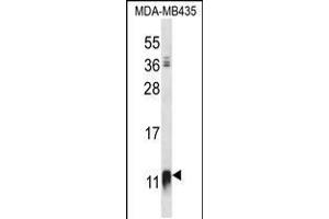 Western blot analysis in MDA-MB435 cell line lysates (35ug/lane). (NDUFAB1 抗体  (C-Term))