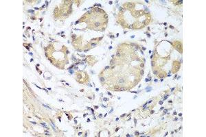 Immunohistochemistry of paraffin-embedded Human stomach using NID1 Polyclonal Antibody at dilution of 1:100 (40x lens). (Nidogen 1 抗体)